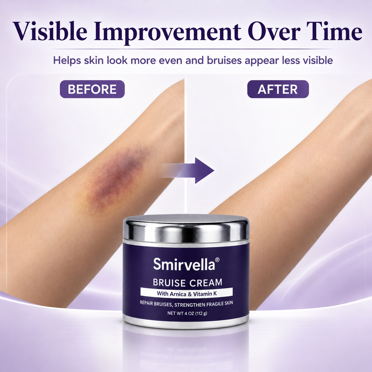 💥Over 100,000 units sold💕 - Bruise Cream to repair bruises and strengthen the skin