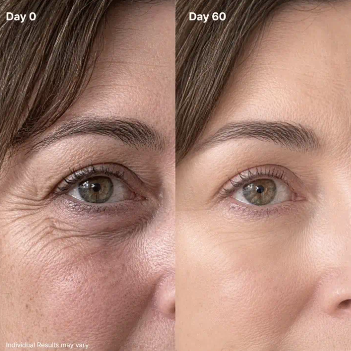 P7 Eye Renewal Cream